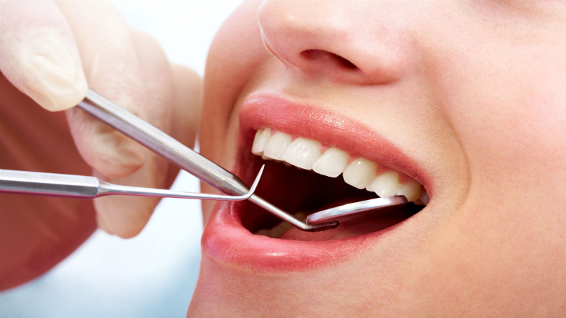 The Importance of Regular Dental Checkups