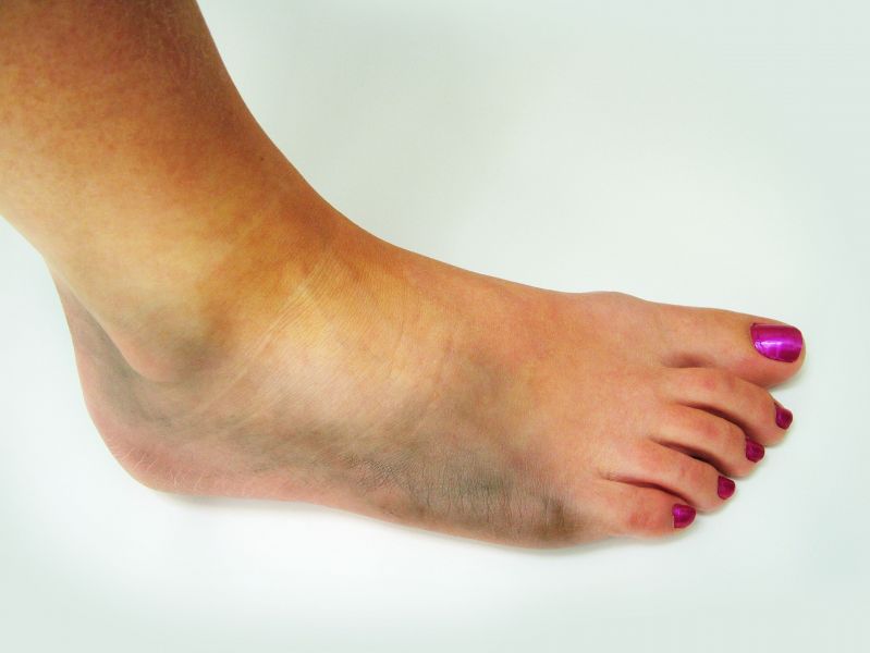 The Treatment Available From A Foot Surgeon