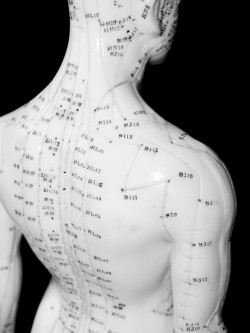 What Are The Benefits of Acupuncture?