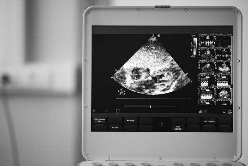 Choose a Reliable Company When You Want To Buy an Ultrasound Machine