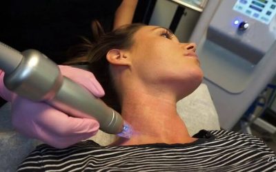 Discover Agnes Laser Treatment in Peachtree City for Clearer Skin