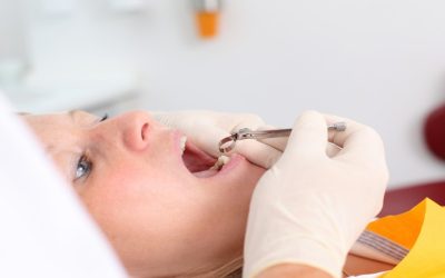 Benefits Of Dental Services In Wilton Manors FL